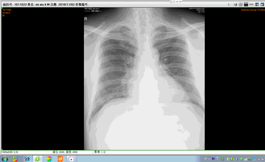 1585101612858305.jpg pacs.jpg